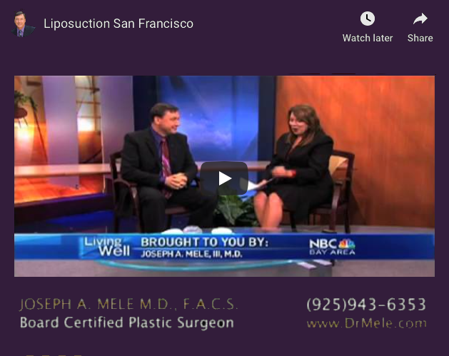 Liposuction Video Presentation with before and after pictures
