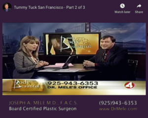 Abdominoplasty Video Presentation with tummy tuck before and after photos
