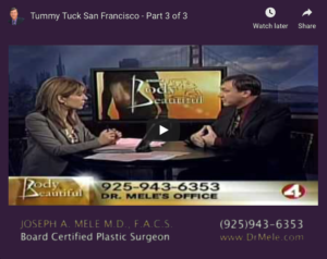 Tummy Tuck Video Presentation with abdominoplasty before and after photos