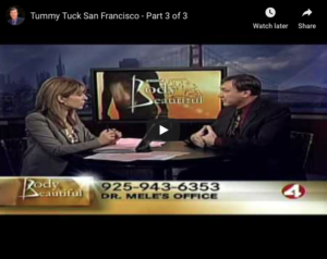 Abdominoplasty (Tummy Tuck) Video Presentation with before and after pictures