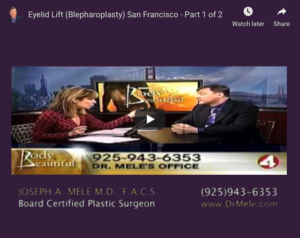 Eyelid Lift Video Presentation with blepharoplasty before and after pictures