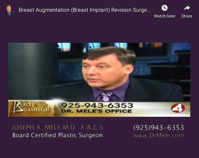 Breast Augmentation Revision Surgery Video Presentation with before and after pictures