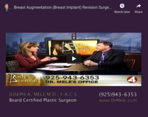 Breast Implant Revision Surgery Video Presentation with before and after pictures