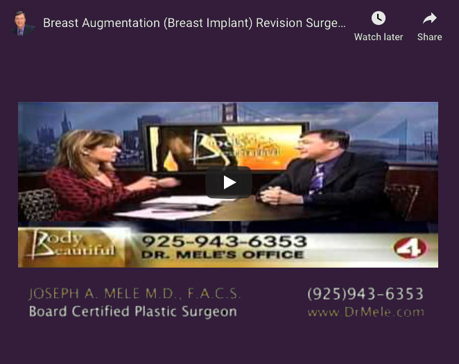 Breast Implant Revision Surgery Video Presentation with before and after pictures