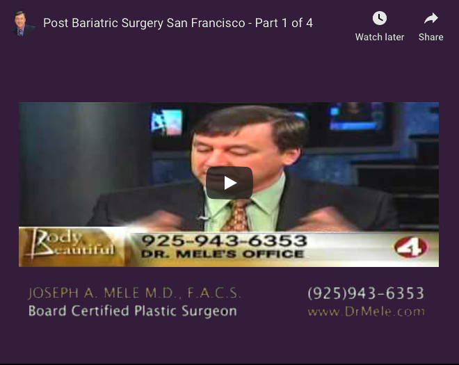 Post Bariatric Plastic Surgery Video Presentation