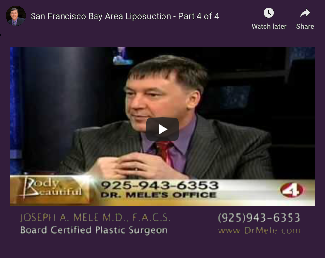 Liposuction Video Presentation with Tumescent Liposuction