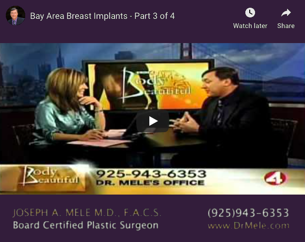 Breast Augmentation Video Presentation