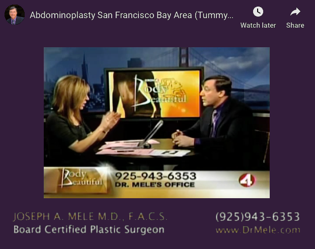 Tummy Tuck Video Presentation (Abdominoplasty)