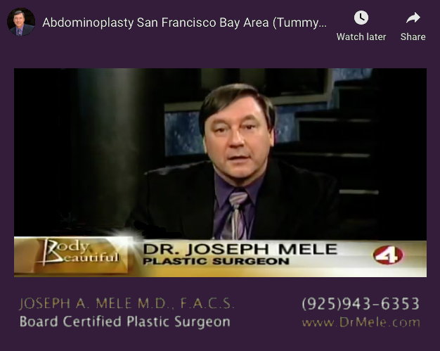 Abdominoplasty (Tummy Tuck) Video Presentation