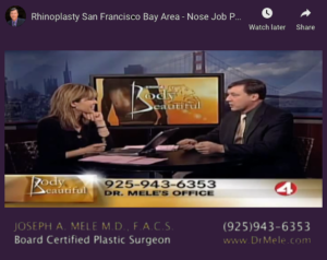 Nasal Surgery (Rhinoplasty) Nose Job Video Presentation