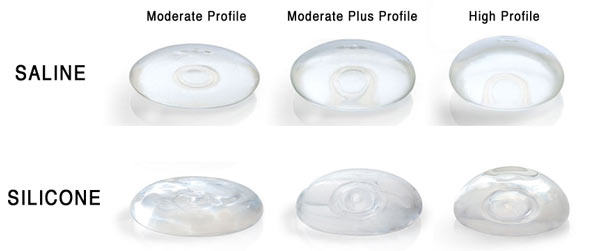 [Jeu] Association d'images - Page 7 Implantprofiles1