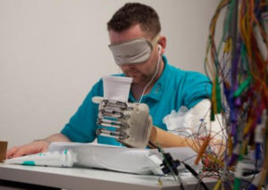 Dennis Aabo Sørenson from Denmark wired with the LifeHand 2 bionic prosthetic in 2013 was able to identify the shape and hardness of items through electrodes implanted in his nerves, while wearing a blindfold and ear buds too. photo credit: LifeHand 2 / Patrizia Tocci