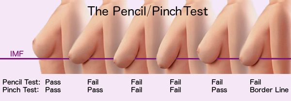 Do I Need A Breast Lift? The Pencil Test vs. The Pinch Test
