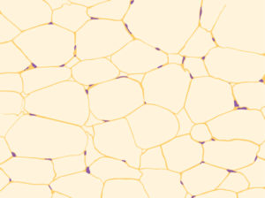 Fat cells are incredibly efficient at storing fat. While most cells look like a fried egg with nucleus the size and proportion of the yolk, fat cells are so full of the fat that the nucleus looks more like the gondola of a blimp. In the picture the nuclei are the small purple dots along edges of the giant fat-filled adipocytes.