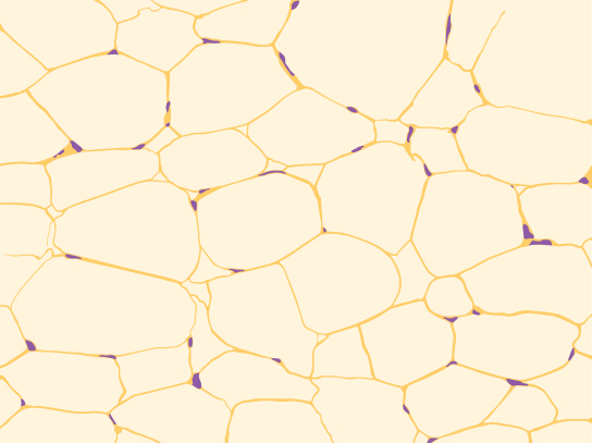 Fat cells are incredibly efficient at storing fat. While most cells look like a fried egg with a nucleus the size and proportion of the yolk, fat cells are so full of fat that the nucleus looks more like the gondola of a blimp. In the picture, the nuclei are the small purple dots along the edges of the giant fat-filled adipocytes.