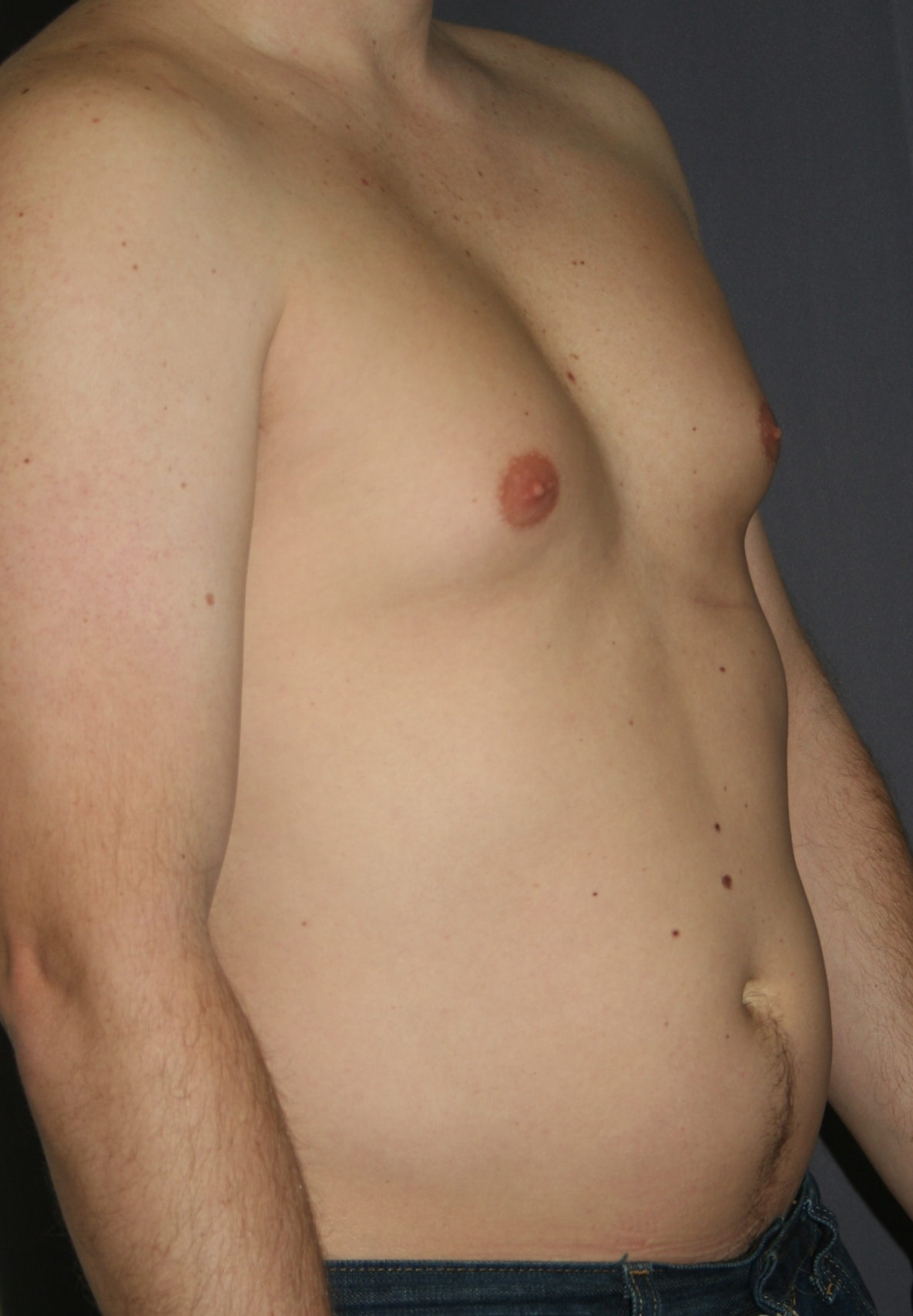 ямки на груди у мужчин фото 113