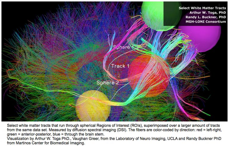 A connectome of the IP addresses of the brain.