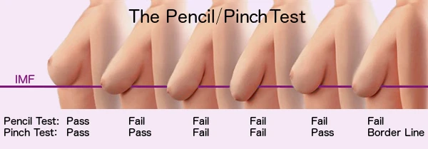 Every woman seems to know about the Pencil Test, but the Pinch Test is better for determining if a Breast Lift is needed.