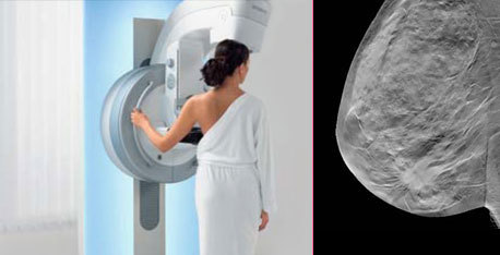 Tomosynthesis promises better pictures with lower radiation and more accurate results for breast cancer screening.