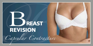Breast Augmentation Revision for Capsular Contracture