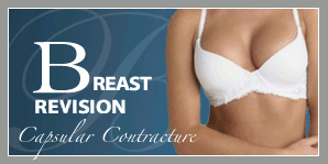 Breast Augmentation Revision for Capsular Contracture Breast Augmentation Revision for Capsular Contracture