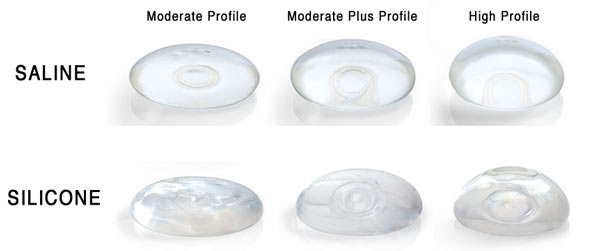 Mentor Breast Implant Profiles