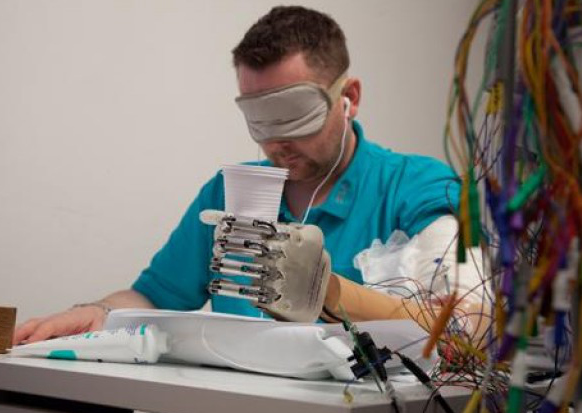 Dennis Aabo Sørenson from Denmark  wired with the LifeHand 2 bionic prosthetic in 2013 was able to identify the shape and hardness of items through electrodes implanted in his nerves, while wearing a blindfold and ear buds too.   photo credit: LifeHand 2 / Patrizia Tocci