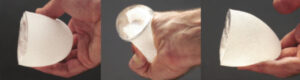 Breast Implants with High Strength Silicon Gel