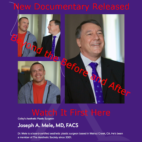 Beyond the Before and After ASAPS Documentary