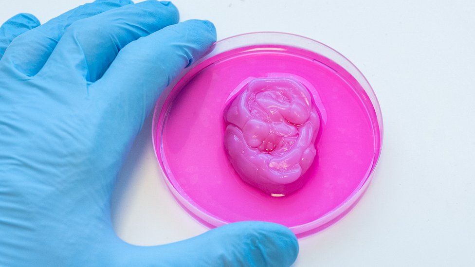 Human cells used to 3D print ear cartilage.