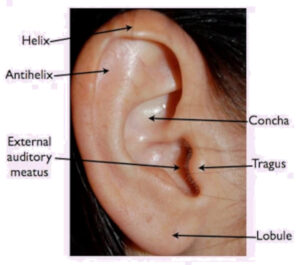 Normal External Ear Anatomy (Pinna)