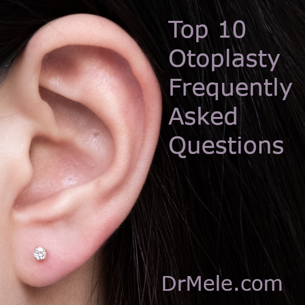Otoplasty FAQs