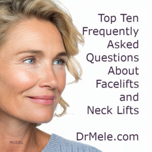 Top 10 FAQs for Facelifts and Neck Lifts.
